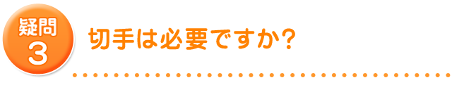 切手は必要ですか？